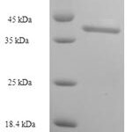 SDS-PAGE separation of QP6237 followed by commassie total protein stain results in a primary band consistent with reported data for Intestine-specific homeobox. These data demonstrate Greater than 90% as determined by SDS-PAGE.