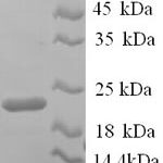 SDS-PAGE separation of QP6240 followed by commassie total protein stain results in a primary band consistent with reported data for Integrin alpha-L. These data demonstrate Greater than 90% as determined by SDS-PAGE.