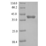 SDS-PAGE separation of QP6245 followed by commassie total protein stain results in a primary band consistent with reported data for Tyrosine-protein kinase JAK1. These data demonstrate Greater than 90% as determined by SDS-PAGE.