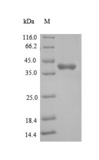 SDS-PAGE separation of QP6245 followed by commassie total protein stain results in a primary band consistent with reported data for Tyrosine-protein kinase JAK1. These data demonstrate Greater than 90% as determined by SDS-PAGE.