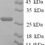 SDS-PAGE separation of QP6247 followed by commassie total protein stain results in a primary band consistent with reported data for JAM-2 / JAM-B. These data demonstrate Greater than 90% as determined by SDS-PAGE.