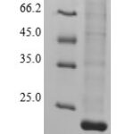 SDS-PAGE separation of QP6257 followed by commassie total protein stain results in a primary band consistent with reported data for Lysine-specific demethylase 5A. These data demonstrate Greater than 90% as determined by SDS-PAGE.