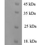 SDS-PAGE separation of QP6258 followed by commassie total protein stain results in a primary band consistent with reported data for VEGFR2 / Flk-1 / CD309 / KDR. These data demonstrate Greater than 90% as determined by SDS-PAGE.