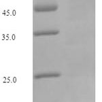 SDS-PAGE separation of QP6259 followed by commassie total protein stain results in a primary band consistent with reported data for KEAP1 / INRF2. These data demonstrate Greater than 90% as determined by SDS-PAGE.