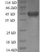 SDS-PAGE separation of QP6263 followed by commassie total protein stain results in a primary band consistent with reported data for Kinesin-like protein KIF1C. These data demonstrate Greater than 90% as determined by SDS-PAGE.