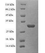 SDS-PAGE separation of QP6269 followed by commassie total protein stain results in a primary band consistent with reported data for Plasma kallikrein. These data demonstrate Greater than 90% as determined by SDS-PAGE.