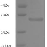 SDS-PAGE separation of QP6270 followed by commassie total protein stain results in a primary band consistent with reported data for NKG2-C type II integral membrane protein. These data demonstrate Greater than 90% as determined by SDS-PAGE.