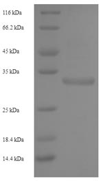 SDS-PAGE separation of QP6270 followed by commassie total protein stain results in a primary band consistent with reported data for NKG2-C type II integral membrane protein. These data demonstrate Greater than 90% as determined by SDS-PAGE.
