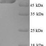 SDS-PAGE separation of QP6271 followed by commassie total protein stain results in a primary band consistent with reported data for Kynurenine 3-monooxygenase. These data demonstrate Greater than 90% as determined by SDS-PAGE.