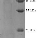 SDS-PAGE separation of QP6276 followed by commassie total protein stain results in a primary band consistent with reported data for Cytokeratin 14. These data demonstrate Greater than 90% as determined by SDS-PAGE.