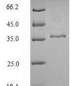 SDS-PAGE separation of QP6279 followed by commassie total protein stain results in a primary band consistent with reported data for Cytokeratin 18. These data demonstrate Greater than 90% as determined by SDS-PAGE.