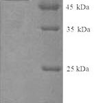 SDS-PAGE separation of QP6281 followed by commassie total protein stain results in a primary band consistent with reported data for Keratin