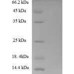 SDS-PAGE separation of QP6284 followed by commassie total protein stain results in a primary band consistent with reported data for Cytokeratin 8. These data demonstrate Greater than 90% as determined by SDS-PAGE.