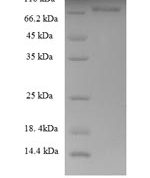 SDS-PAGE separation of QP6284 followed by commassie total protein stain results in a primary band consistent with reported data for Cytokeratin 8. These data demonstrate Greater than 90% as determined by SDS-PAGE.