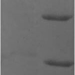 SDS-PAGE separation of QP6289 followed by commassie total protein stain results in a primary band consistent with reported data for Plastin-2. These data demonstrate Greater than 90% as determined by SDS-PAGE.