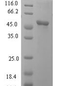 SDS-PAGE separation of QP6291 followed by commassie total protein stain results in a primary band consistent with reported data for L-lactate dehydrogenase C chain. These data demonstrate Greater than 90% as determined by SDS-PAGE.