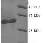 SDS-PAGE separation of QP6294 followed by commassie total protein stain results in a primary band consistent with reported data for Galectin-1 / LGALS1. These data demonstrate Greater than 90% as determined by SDS-PAGE.