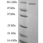 SDS-PAGE separation of QP6296 followed by commassie total protein stain results in a primary band consistent with reported data for Galectin-3-binding protein. These data demonstrate Greater than 90% as determined by SDS-PAGE.