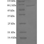 SDS-PAGE separation of QP6298 followed by commassie total protein stain results in a primary band consistent with reported data for Galectin-6. These data demonstrate Greater than 90% as determined by SDS-PAGE.