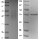 SDS-PAGE separation of QP6302 followed by commassie total protein stain results in a primary band consistent with reported data for Legumain /  LGMN. These data demonstrate Greater than 90% as determined by SDS-PAGE.