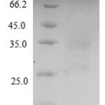 SDS-PAGE separation of QP6304 followed by commassie total protein stain results in a primary band consistent with reported data for LH-beta. These data demonstrate Greater than 90% as determined by SDS-PAGE.