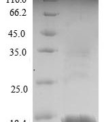 SDS-PAGE separation of QP6304 followed by commassie total protein stain results in a primary band consistent with reported data for LH-beta. These data demonstrate Greater than 90% as determined by SDS-PAGE.
