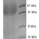 SDS-PAGE separation of QP6305 followed by commassie total protein stain results in a primary band consistent with reported data for Lutropin-choriogonadotropic hormone receptor. These data demonstrate Greater than 90% as determined by SDS-PAGE.