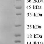 SDS-PAGE separation of QP6308 followed by commassie total protein stain results in a primary band consistent with reported data for DNA ligase 1. These data demonstrate Greater than 90% as determined by SDS-PAGE.