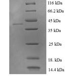 SDS-PAGE separation of QP6310 followed by commassie total protein stain results in a primary band consistent with reported data for LIM domain-containing protein 2. These data demonstrate Greater than 90% as determined by SDS-PAGE.