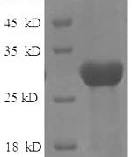 SDS-PAGE separation of QP6314 followed by commassie total protein stain results in a primary band consistent with reported data for Protein-lysine 6-oxidase. These data demonstrate Greater than 90% as determined by SDS-PAGE.