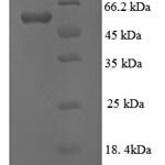 SDS-PAGE separation of QP6315 followed by commassie total protein stain results in a primary band consistent with reported data for Lysyl oxidase homolog 1. These data demonstrate Greater than 90% as determined by SDS-PAGE.