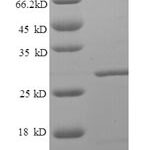 SDS-PAGE separation of QP6318 followed by commassie total protein stain results in a primary band consistent with reported data for LRBA. These data demonstrate Greater than 90% as determined by SDS-PAGE.