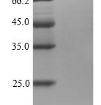 SDS-PAGE separation of QP6320 followed by commassie total protein stain results in a primary band consistent with reported data for LRP4. These data demonstrate Greater than 95% as determined by SDS-PAGE.