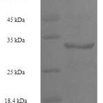 SDS-PAGE separation of QP6322 followed by commassie total protein stain results in a primary band consistent with reported data for U6 snRNA-associated Sm-like protein LSm4. These data demonstrate Greater than 90% as determined by SDS-PAGE.