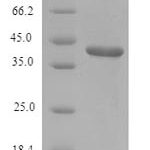 SDS-PAGE separation of QP6324 followed by commassie total protein stain results in a primary band consistent with reported data for Lumican / LUM. These data demonstrate Greater than 90% as determined by SDS-PAGE.