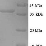 SDS-PAGE separation of QP6335 followed by commassie total protein stain results in a primary band consistent with reported data for Microtubule-associated protein 2. These data demonstrate Greater than 90% as determined by SDS-PAGE.