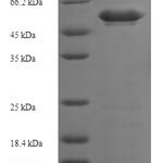 SDS-PAGE separation of QP6336 followed by commassie total protein stain results in a primary band consistent with reported data for MAP2K3. These data demonstrate Greater than 90% as determined by SDS-PAGE.