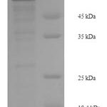 SDS-PAGE separation of QP6342 followed by commassie total protein stain results in a primary band consistent with reported data for JNK2 / MAPK9. These data demonstrate Greater than 90% as determined by SDS-PAGE.