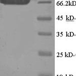 SDS-PAGE separation of QP6345 followed by commassie total protein stain results in a primary band consistent with reported data for MAPT / Tau. These data demonstrate Greater than 90% as determined by SDS-PAGE.