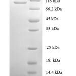 SDS-PAGE separation of QP6349 followed by commassie total protein stain results in a primary band consistent with reported data for DNA replication licensing factor MCM2. These data demonstrate Greater than 90% as determined by SDS-PAGE.