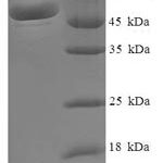 SDS-PAGE separation of QP6352 followed by commassie total protein stain results in a primary band consistent with reported data for Malate dehydrogenase