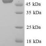 SDS-PAGE separation of QP6353 followed by commassie total protein stain results in a primary band consistent with reported data for E3 ubiquitin-protein ligase Mdm2. These data demonstrate Greater than 90% as determined by SDS-PAGE.