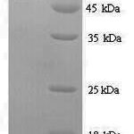 SDS-PAGE separation of QP6355 followed by commassie total protein stain results in a primary band consistent with reported data for METAP2 / MAP2. These data demonstrate Greater than 90% as determined by SDS-PAGE.