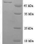 SDS-PAGE separation of QP6355 followed by commassie total protein stain results in a primary band consistent with reported data for METAP2 / MAP2. These data demonstrate Greater than 90% as determined by SDS-PAGE.