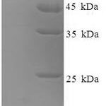 SDS-PAGE separation of QP6357 followed by commassie total protein stain results in a primary band consistent with reported data for MFI2 / CD228 / melanotransferrin. These data demonstrate Greater than 90% as determined by SDS-PAGE.