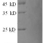 SDS-PAGE separation of QP6359 followed by commassie total protein stain results in a primary band consistent with reported data for Matrix Gla protein. These data demonstrate Greater than 90% as determined by SDS-PAGE.