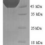 SDS-PAGE separation of QP6360 followed by commassie total protein stain results in a primary band consistent with reported data for Minpp1. These data demonstrate Greater than 90% as determined by SDS-PAGE.