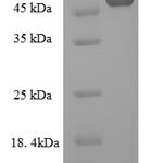 SDS-PAGE separation of QP6367 followed by commassie total protein stain results in a primary band consistent with reported data for Collagenase 3. These data demonstrate Greater than 80% as determined by SDS-PAGE.