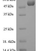 SDS-PAGE separation of QP6367 followed by commassie total protein stain results in a primary band consistent with reported data for Collagenase 3. These data demonstrate Greater than 80% as determined by SDS-PAGE.