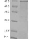 SDS-PAGE separation of QP6369 followed by commassie total protein stain results in a primary band consistent with reported data for MMP-2 / CLG4A Protein. These data demonstrate Greater than 90% as determined by SDS-PAGE.